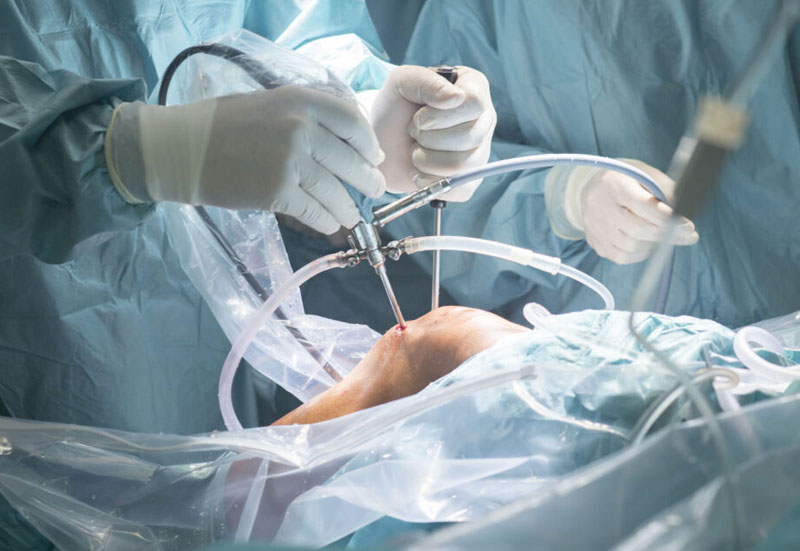 Ortopedia zabiegi chirurgiczne