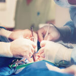 wymiana stawu biodrowego