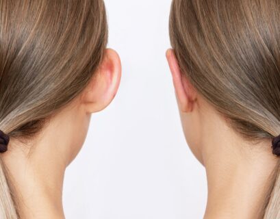 korekta uszu, korekta odstających uszu, ilustracja możliwego rezultatu operacji